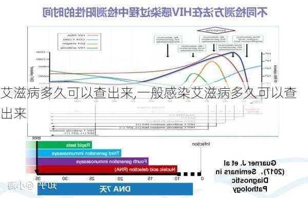 艾滋病多久可以查出来,一般感染艾滋病多久可以查出来-第3张图片-欣雨出游网